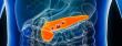 Pancreatic Cancer Treatment Market to Reach US$ 12.6 Bn by 2033 | Persistence Market Research