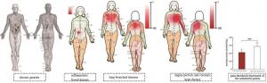 24826038 fig 1 occurrence of body surfa