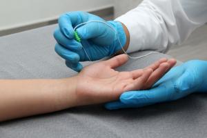 Electrodiagnostic Testing