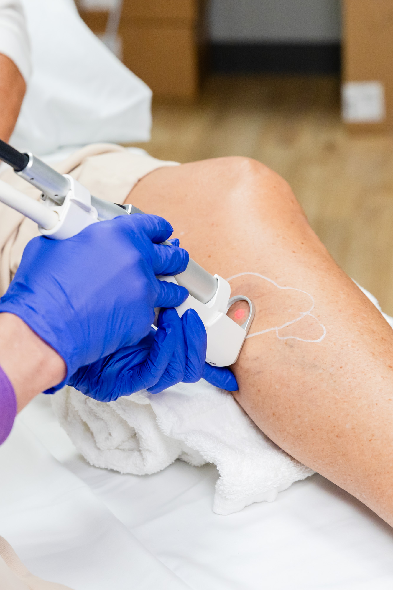 Spring Ready Legs: Akribis Veins & Vitality Encourages Early Treatment for Spider and Varicose Veins