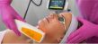 Skin Luxe Now Offering Nordlys® Laser Treatments by Candela in Lake Charles, LA