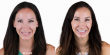 Esthetic Dentistry Puerto Vallarta Prioritizes Tooth Preservation as Aggressive Smile Makeover Trends Grow