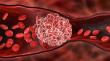 Venous Thromboembolism Treatment Market Size to Expand from US$2.6Bn to US$3.5Bn, Says Persistence Market Research