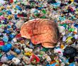 Microplastic burden in the human brain linked to stroke and dementia: apheresis emerging as the first plausible removal