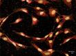 Blocking TGF-β Signaling May Strengthen Efficacy of Osteoporosis Therapy