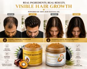 24858322 hair loss