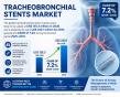 Tracheobronchial Stents Market to Reach US$ 220.1 Million by 2033 at 7.2% CAGR | Persistence Market Research