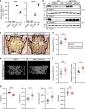 Bone Cells Use Vitamin K Signals to Regulate Osteoclast Fusion
