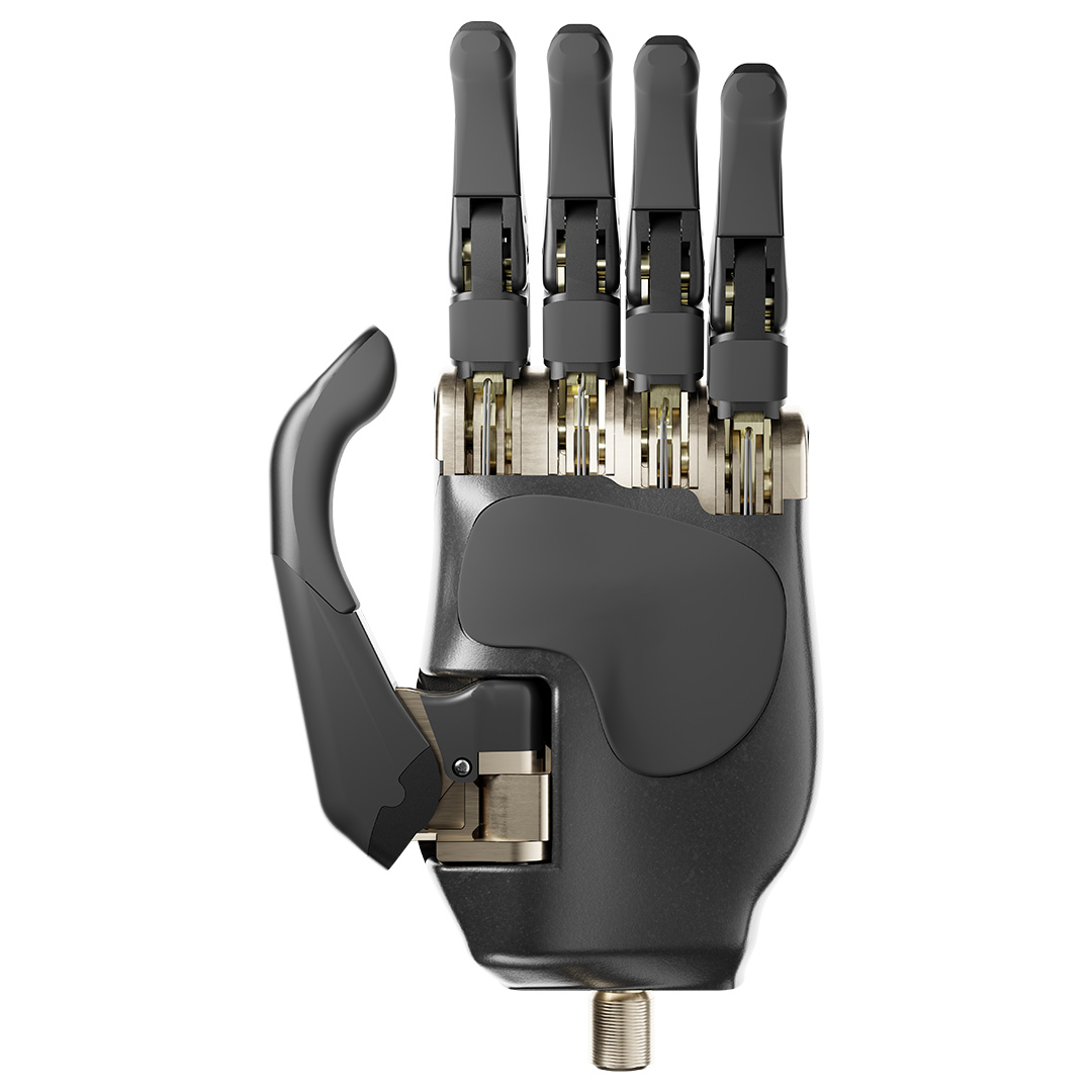 Metacarpal Announces Exclusive Distribution Agreement with Ortho-Reha Neuhof for Revolutionary Body-Powered Hand