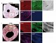 AI-powered nonlinear optical imaging reveal protein spatial homogenization as indicator of bone quality type 2 diabetes