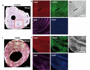 Figure 1 Multimodal nonlinear optical imaging of the osteon.