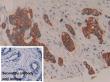 Antibody Selection Strategy: Precisely Match Research Needs, Say Goodbye to Selection Difficulties