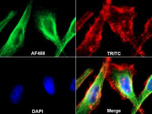 Figure 3: HepG2 cell multiple immunofluorescence staining experiment