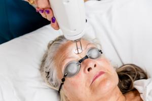 Laser Skin Resurfacing at Akribis