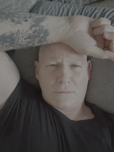 bald from chemo. resting at home, inbetween hospital stays.
