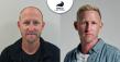  Why Australian and New Zealand Patients Are Choosing Turkey for Hair Transplants