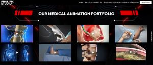 Prolific Studio, a leading medical animation company headquartered in Palo Alto, California, today announced a major milestone: more than 100 medical and healthcare animation projects delivered since the studio launched its dedicated medical animation division in 2020 Medical Animation Company