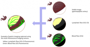 [Fig. 1] Simultaneous Visualization of Blood Flow and Lymphatic Flow Using a Multi-Fluorescence Imaging Camera (illustration)