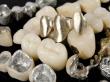 Dental Alloys Market Driven by Rising Demand for Dental Implants and Growing Geriatric Population