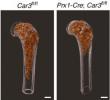 Scientists Uncover Key Protein That Helps Build and Strengthen Bone