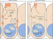 How a Single Genetic Change Derails Enamel Formation in Developing Teeth