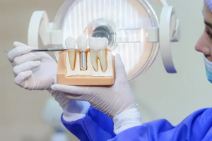 Dental Implant Cost in Melbourne