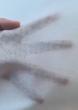 Specialized Substrate for Plasters & Wound Dressings: Performance Advantages of YDL Medical Spunlaced Nonwovens