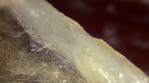 Many people live with long-term pain in their muscles and joints that no X-ray or MRI can explain Magnified view of living fascia recorded during endoscopic surgery by French surgeon Jean-Claude Guimberteau.
