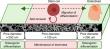 Engineered 'Bone-Suture-Bone' Implant Promotes Normal Skull Growth