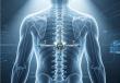 Leading China Spinal Implants Manufacturers for Saudi Arabia’s Spine Surgery Market