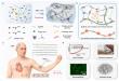 Soft adhesive hydrogel improves long-term wearable health monitoring