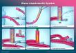 JTCVS Publishes AMT Medical's SAFE-CAB II: Sutureless, Laser-Assisted Coronary Bypass Proves Safe at One Year