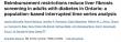 New Study Finds OHIP Reimbursement Restrictions Reduced Liver Fibrosis Screening in Diabetes