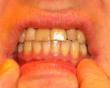 International Expert Consensus Guidance for Adult Orthodontic Care