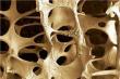 A New Way to Build Stronger Bones: Blocking Axl Shows Promise