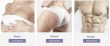 Buttock Hyaluronic Acid Fillers: Body Contouring Trends in Brazil and Lumicen's Solutions