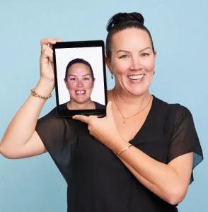 Cosmetic Dentistry Treatment Perth