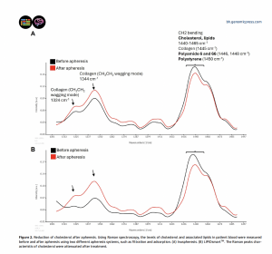 Reduction of cholesterol after apheresis.
