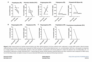 Micro- and nanoplastics (MNPs) measurements of patient plasma before and after double-filtration plasmapheresis (DFPP) treatment.