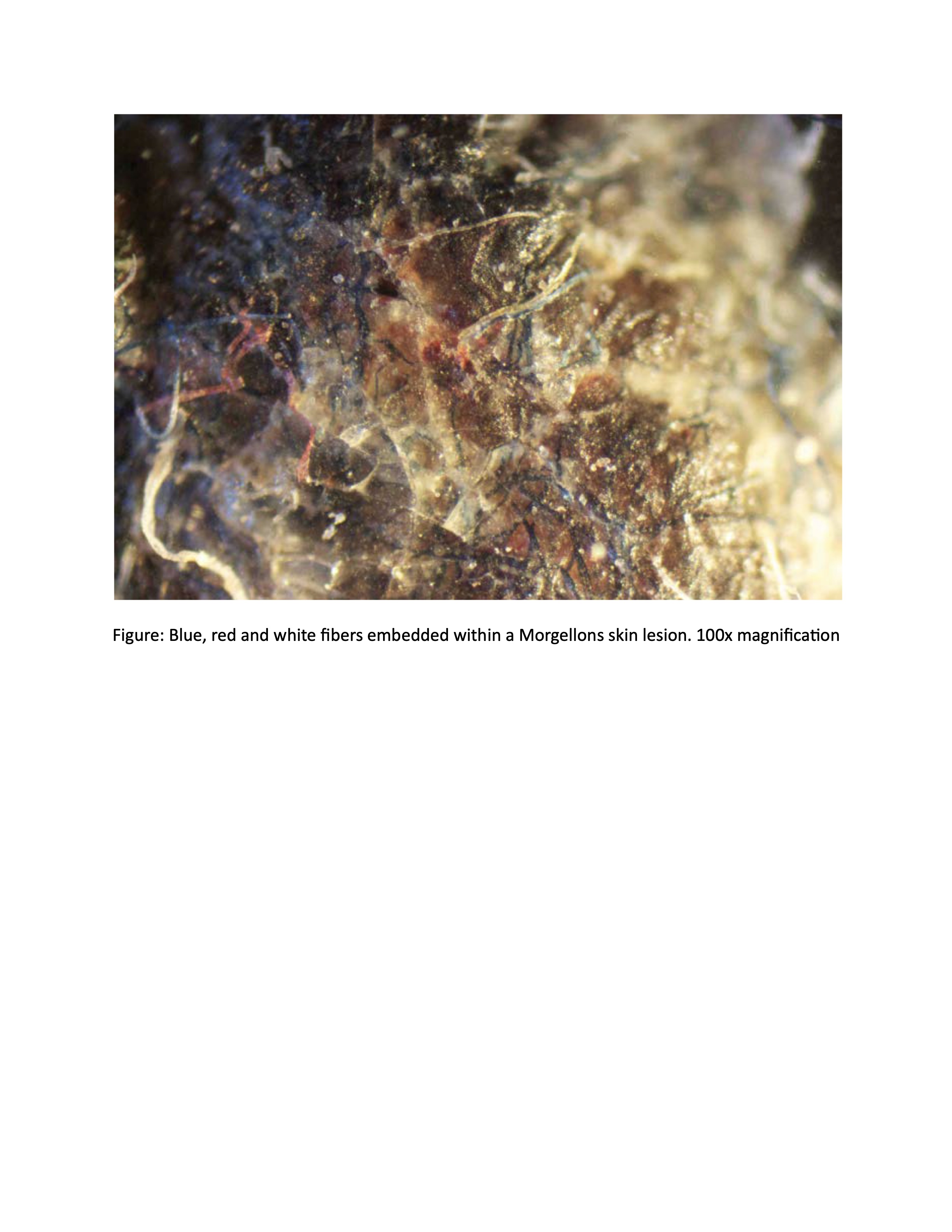 The Scientific Odyssey of Morgellons Disease Over Two Decades