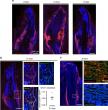New Study Reveals Muscle’s Role in Fracture Repair
