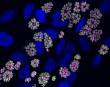 New study shows how Toxoplasma parasite evolved to adapt to crowded conditions in host cells