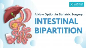 Intestinal Bipartition (IB) Surgery in Tijuana, Mexico