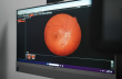 Texas State Optical At Briargrove Urges Early Glaucoma Testing to Fight the Silent Thief of Sight in Houston