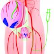 North Star Vascular & Interventional to Host Hemorrhoidal Artery Embolization (HAE) Summit Course