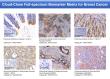 Breakthrough&Empowerment: Cloud-Clone Pioneers Advanced Biomarker Panels in New Era of Precision Breast Cancer Research