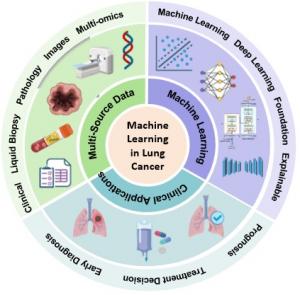 Multi-source data-driven machine learning for lung cancer diagnosis, treatment, and prognosis