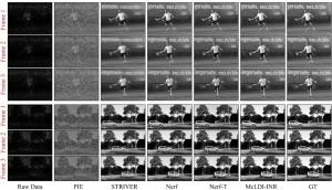 Fig. 2. Visual comparison between McLDI-INR and baseline methods