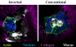 Researchers Discover Molecular Mechanism That Helps Aggressive Colorectal Cancer to Spread