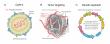 FDA Authorizes Injection of Tumor Targeted Gene Therapy Directly into Cerebrospinal Fluid  for Leptomeningeal Disease